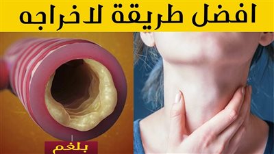 تخلص من البلغم المزعج في 6 خطوات سهلة